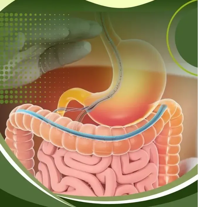 DigestSync is a cutting-edge, all-natural supplement designed to transform digestive health and enhance overall well-being