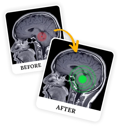 The Wealth Signal using effect - before: after